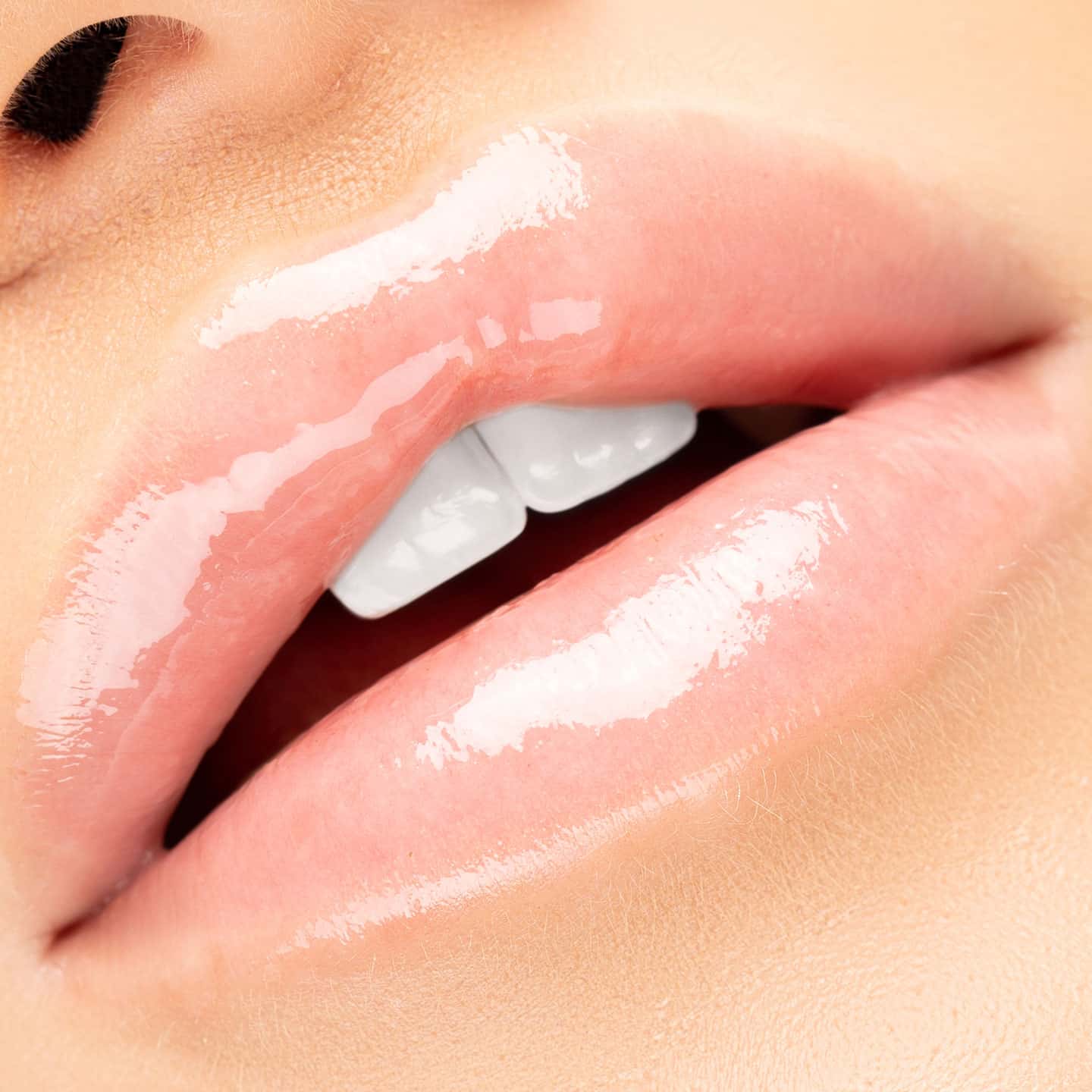 Killer Lips